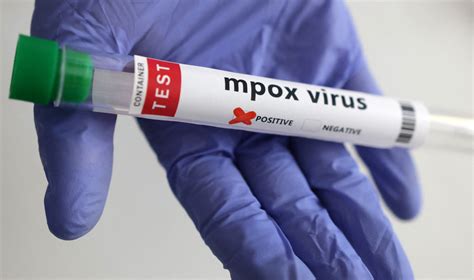 big ass pervmom|Mpox: Thailand confirms Clade 1b strain for first time in Asia .